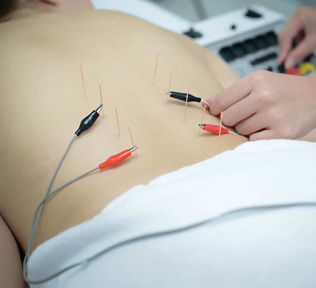 clinica de fisioterapia invasiva en gijon