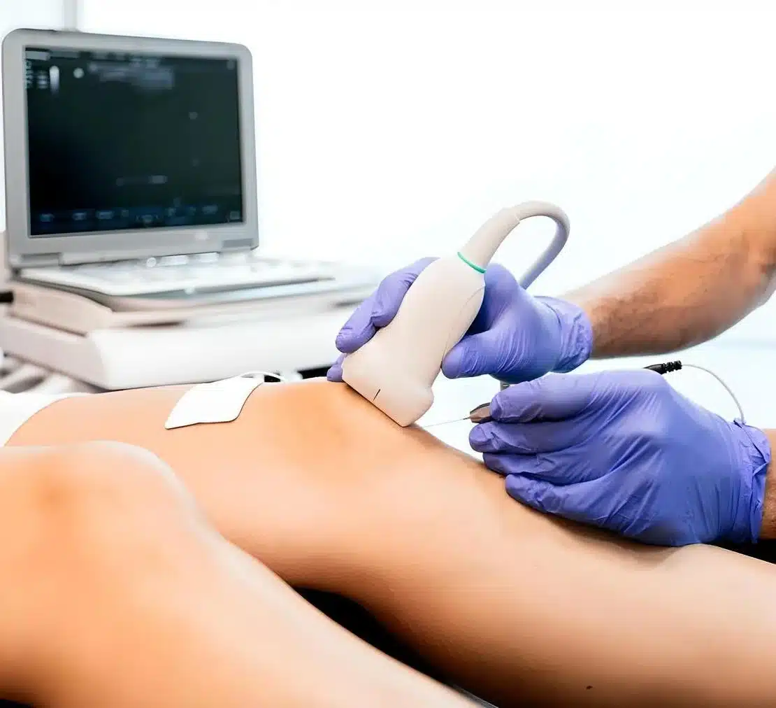 profesional realizando ecografia rodilla paciente