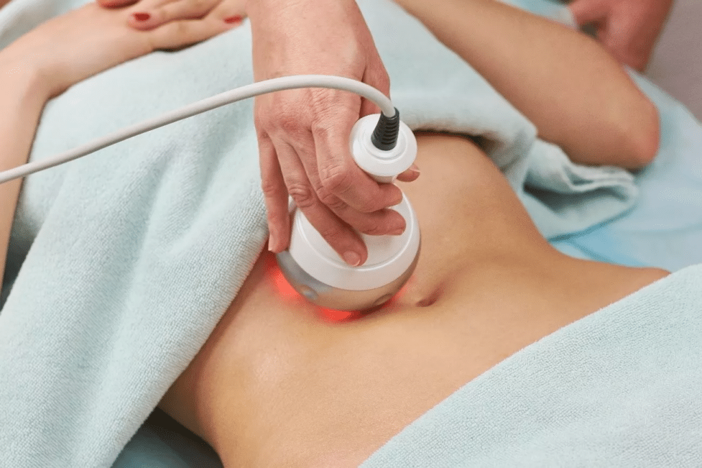 fisio aplicando radiofrecuencia a una paciente